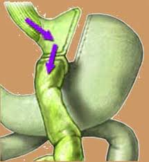 World Laparoscopy Hospital Announces Affordable Low Cost Laparoscopic Bariatric Surgery