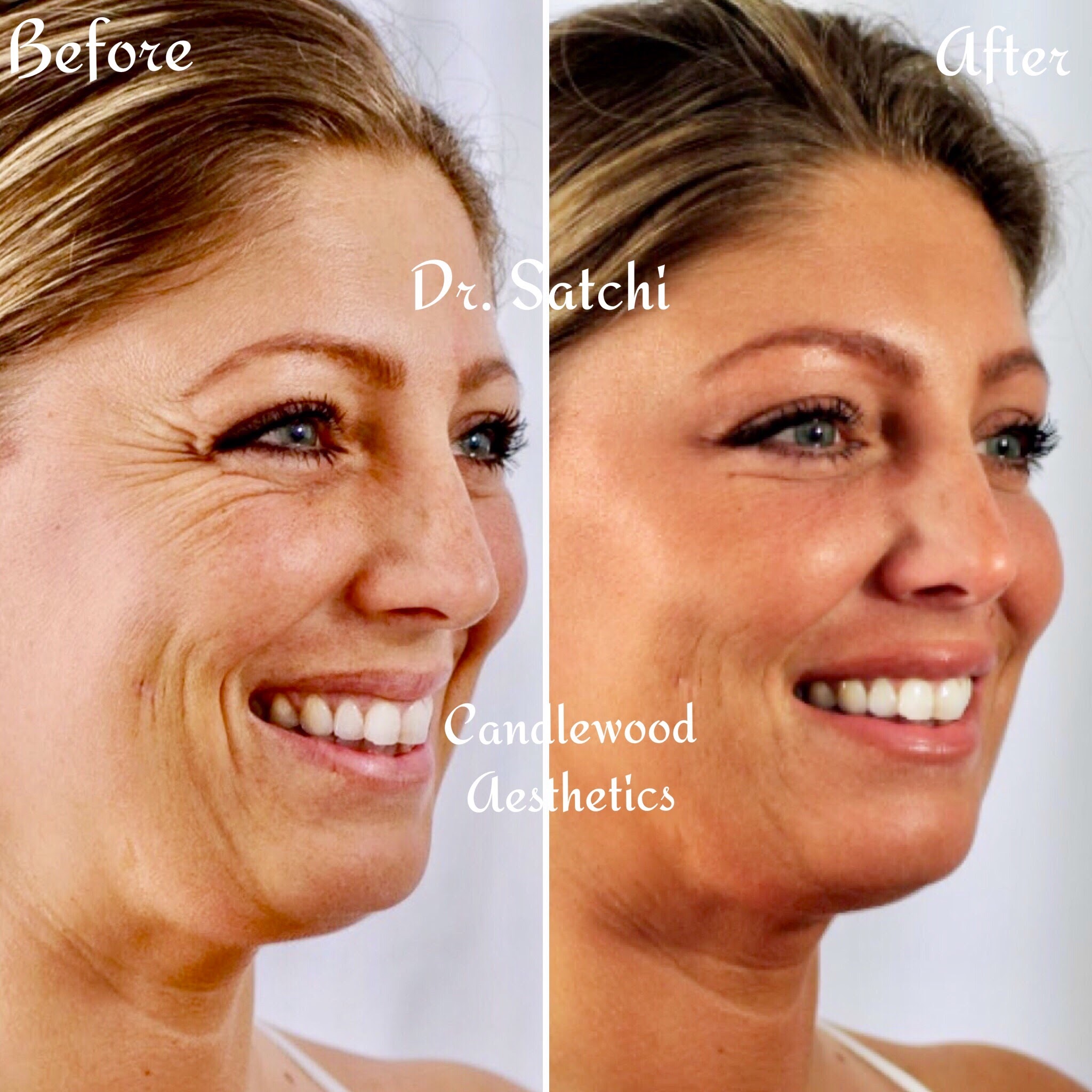 Candlewood Aesthetics Total Beauty Makeover Blog Series Showcases Dramatic Beauty Transformations