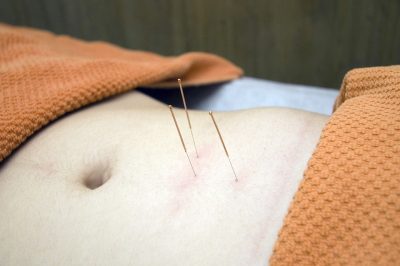 YinsClinic.com Publishes Intriguing Article on the Benefits of Acupuncture for Weight Loss
