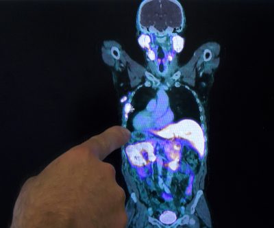 Intermountain Health and PharmaLogic Partner on Leading Edge Medical Imaging for Patients