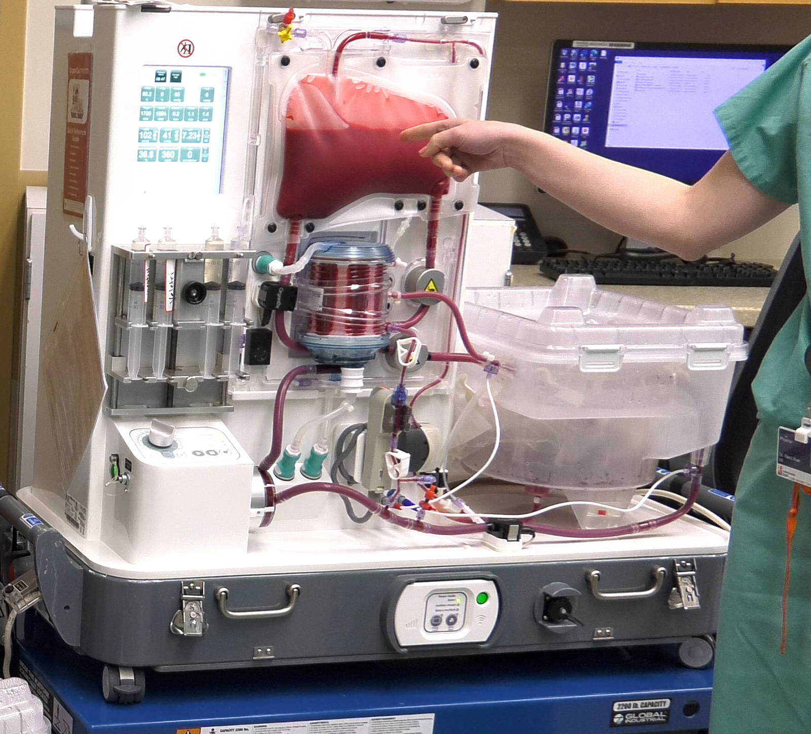 Utah’s First Use of State-of-the-Art Organ-Saving Technology Announced By Intermountain Health Transplant Program