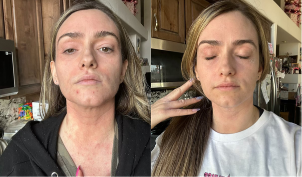 Hollywood's Secret Anti-Aging Needle Has a Name: GHK-Cu Peptide — Here's the Exact Dosage Flooding Biohacker Group Chats