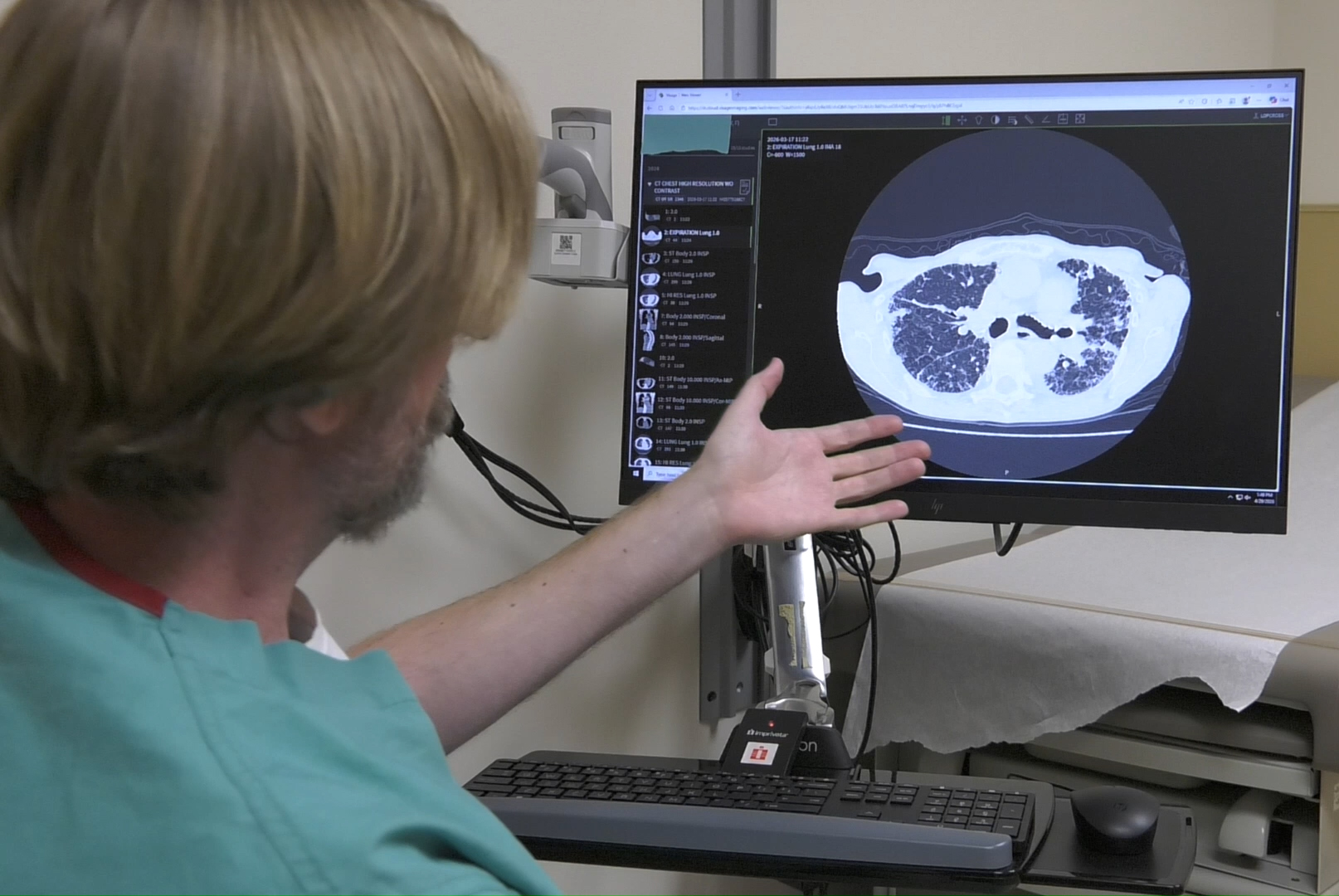 Intermountain Health AI Tech. Study is a ‘Game Changer’ for Treating Two Common Pulmonary Conditions